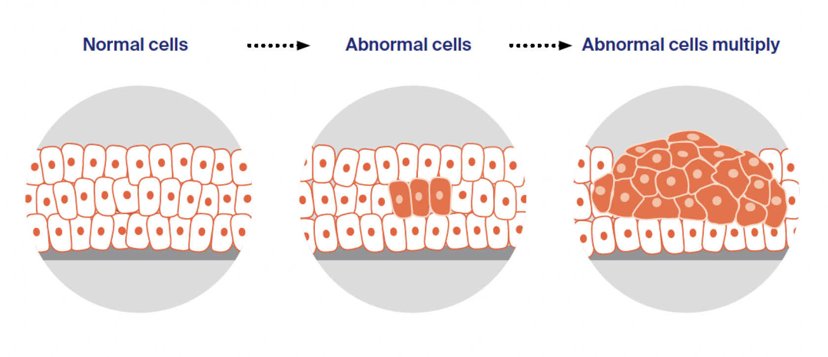 How cancer starts: cell diagram 