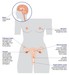 computer image of female reproductive organs including breasts and uterus