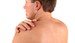 Man with his hand on bare shoulder showing moles